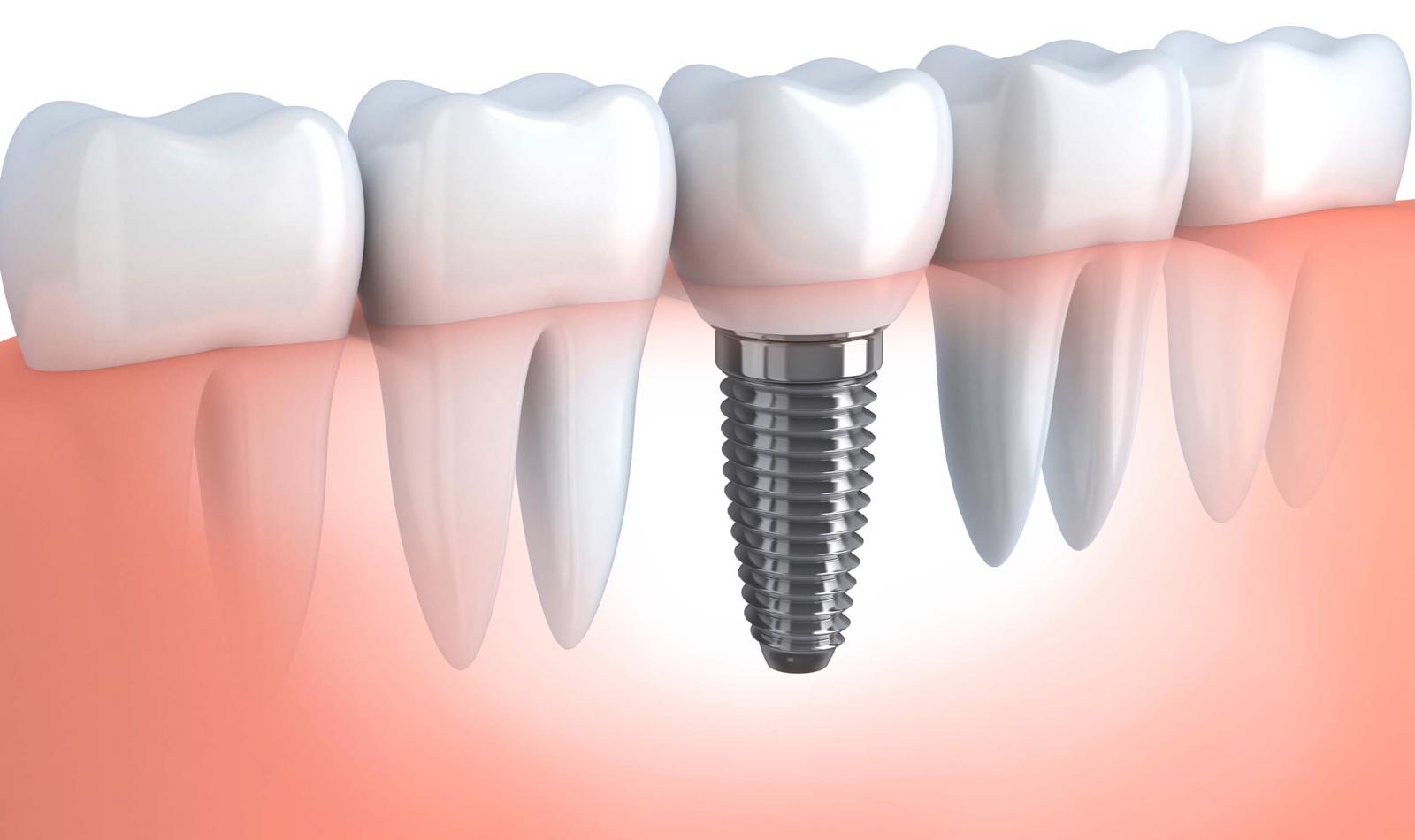 Best Dentist in Islamabad