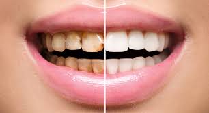 Dental Clinic of Islamabad and Rawalpindi