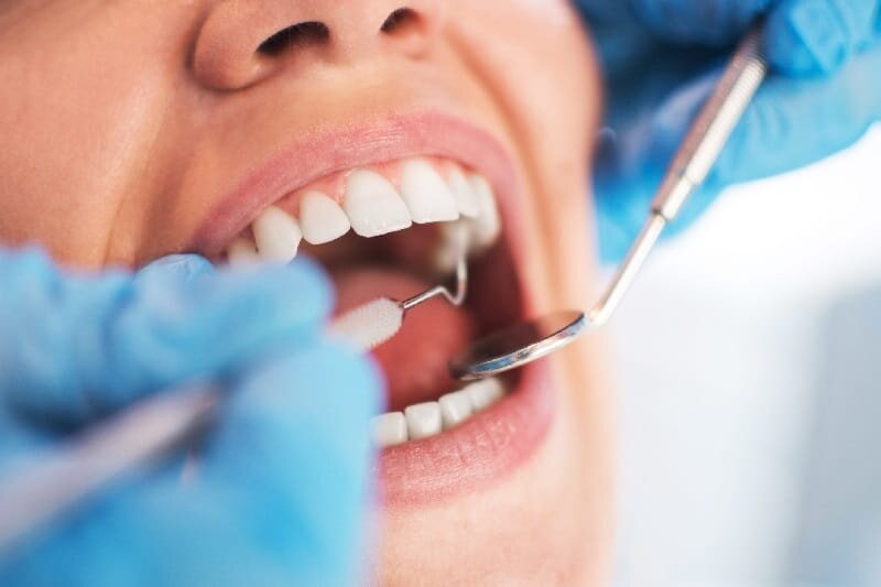 Dental Clinic Rawalpindi and Islamabad