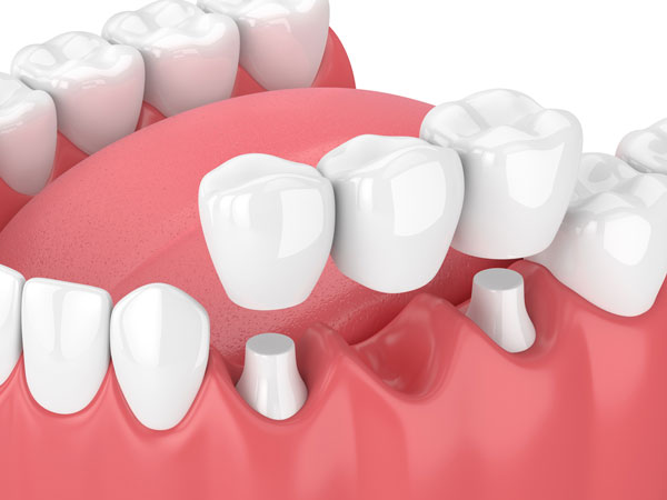 Dental Clinic Rawalpindi